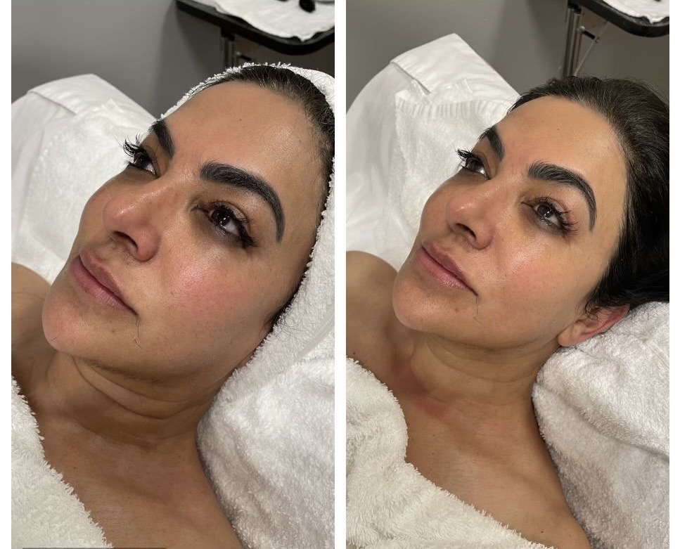 Facial Glow